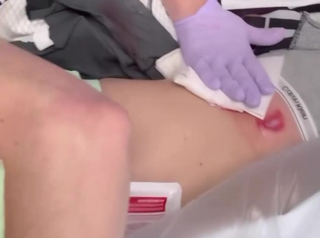 Mikaela Shiffrin describe como una 'puñalada' su herida y deberá